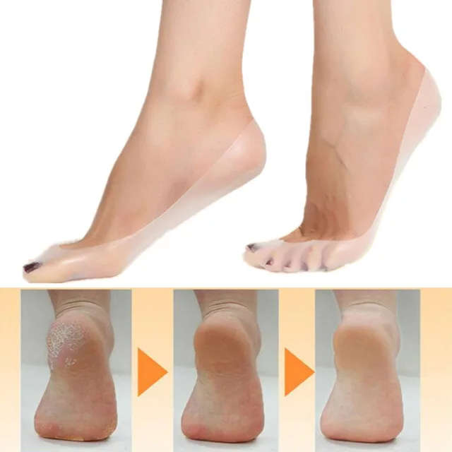 ANTI CRACK SILICONE SOCKS