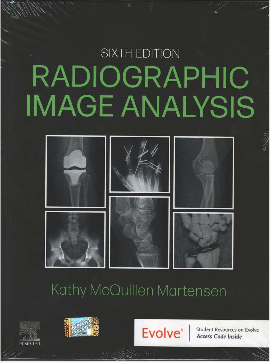 RADIOGRAPHIC IMAGE ANALYSIS 6ED - MARTENSEN