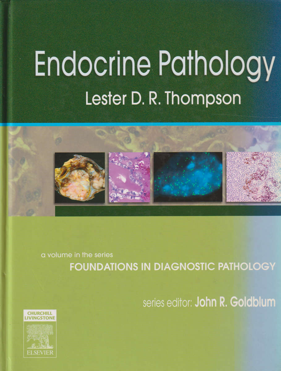Endocrine Pathology - THOMPSON,L