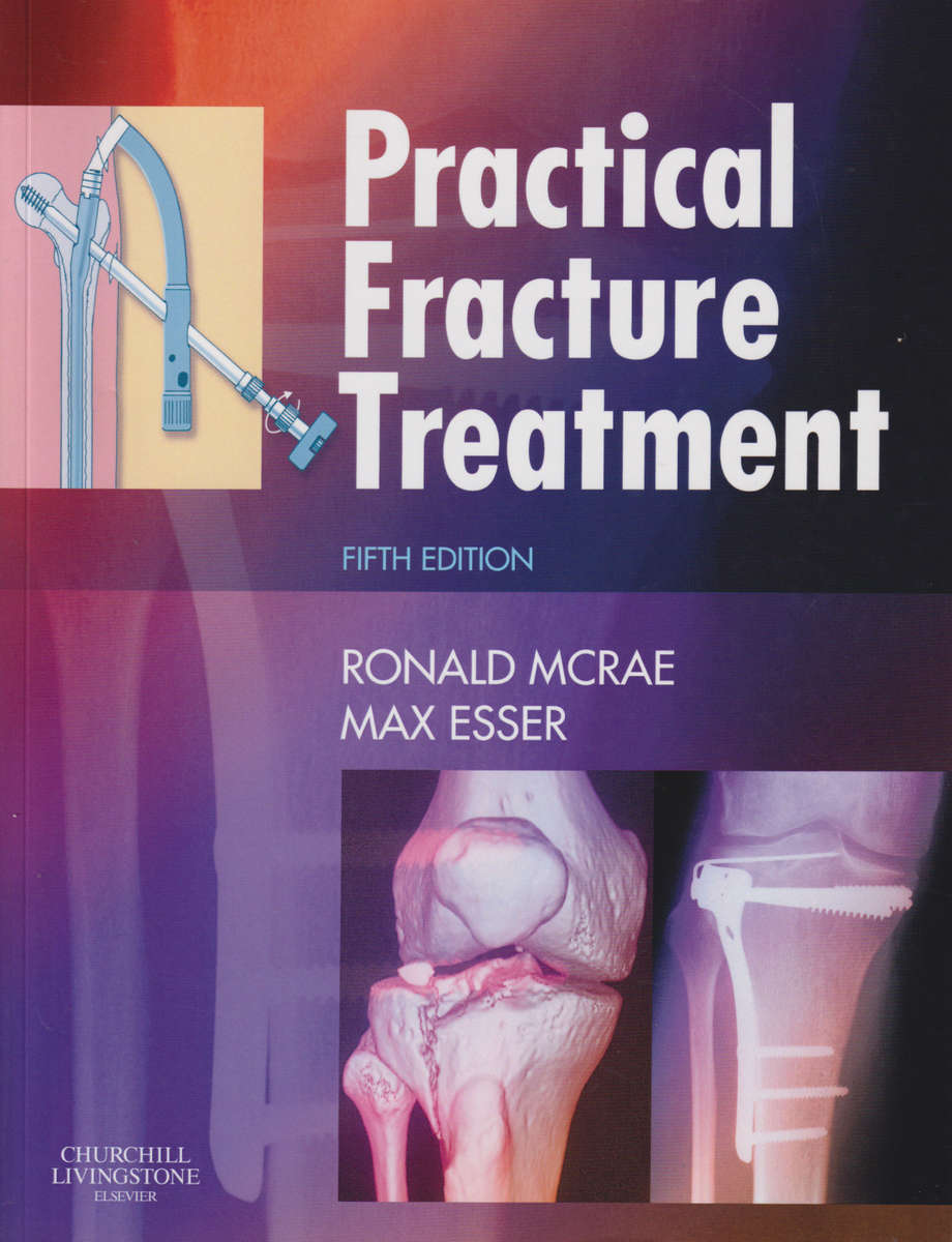 PRACTICAL FRACTURE TREATMENT 5ED INT ED - MCRAE