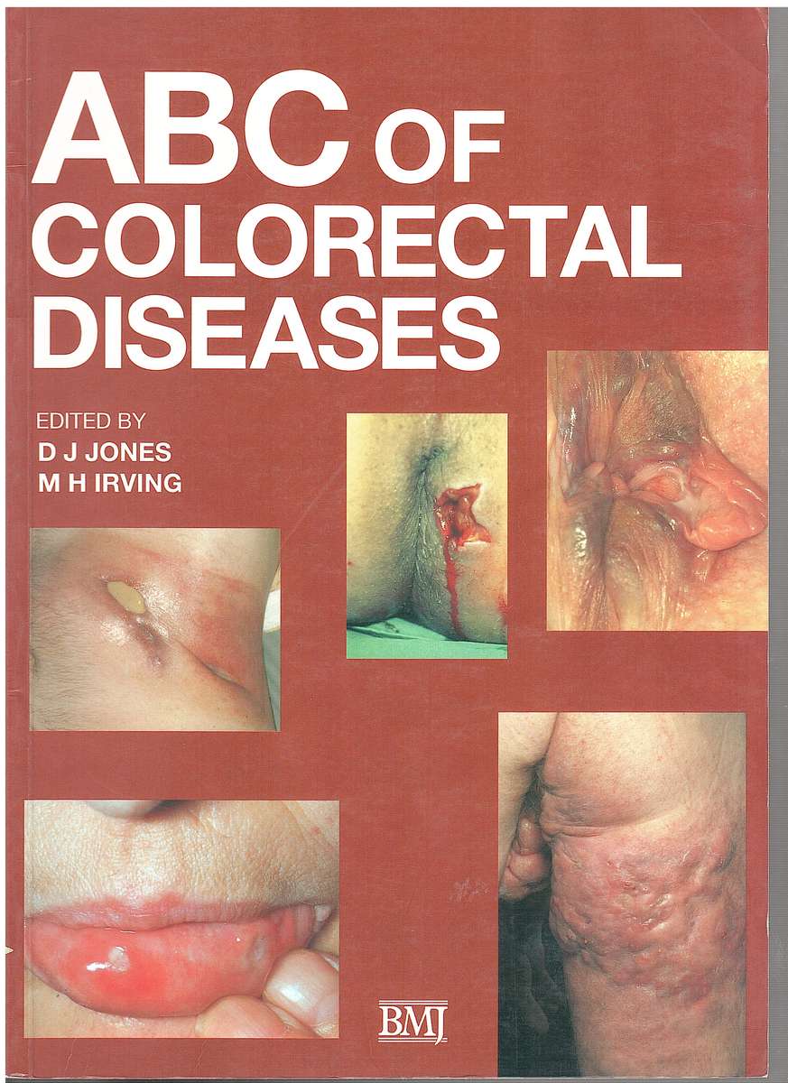 ABC OF COLORECTAL DISEASES SECONDHAND - JONES