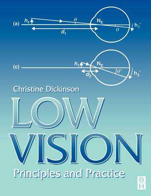 Low Vision - Christine Dickinson