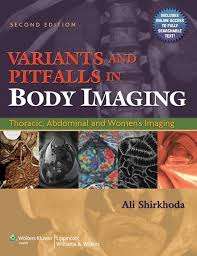 Variants and Pitfalls in Body Imaging - Ali Shirkhoda
