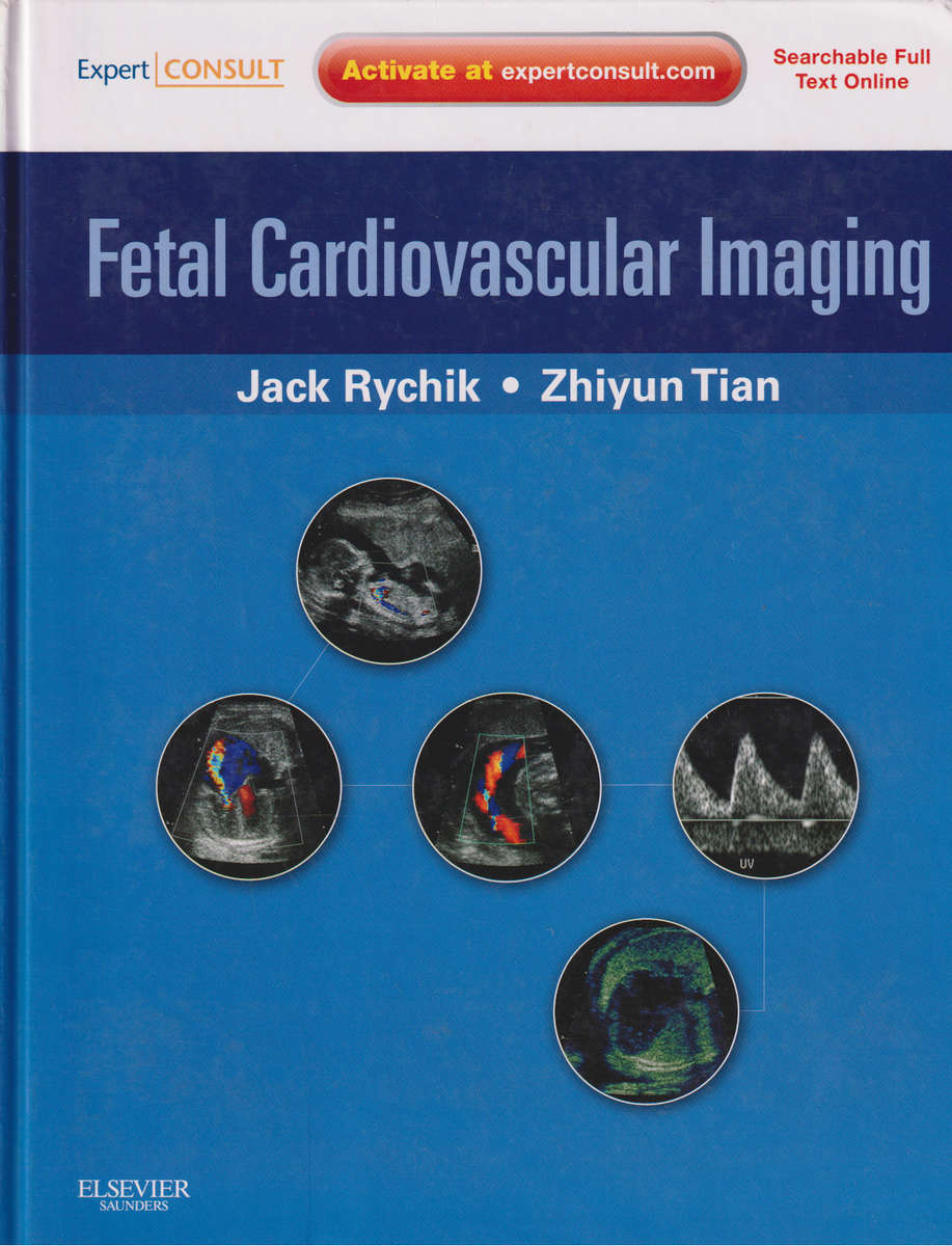 Fetal Cardiovascular Imaging: A Disease Based Approach - Jack Rychik