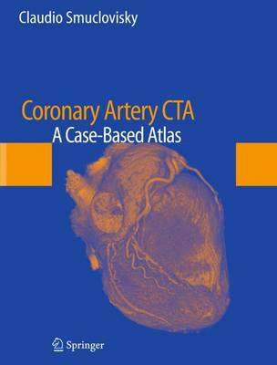 Coronary Artery CTA - Claudio Smuclovisky