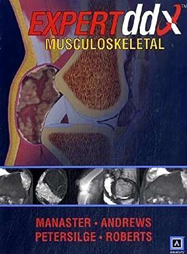 EXPERTddx : Musculoskeletal - B. J. Manaster
