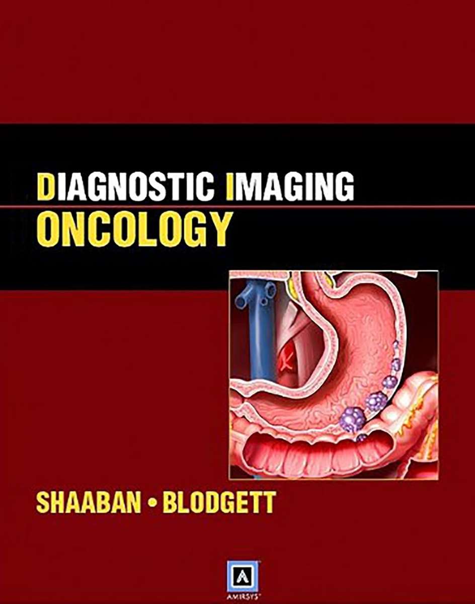 Diagnostic Imaging: Oncology - Akram M. Shaaban