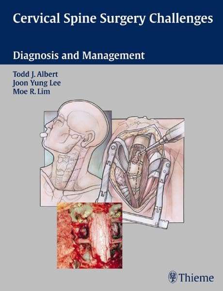 CERVICAL SPINE SURGERY CHALLEGES - ALBERT,T