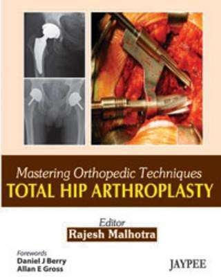 Mastering Orthopedic Techniques: Total Hip Arthroplasty - Rajesh Malhotra