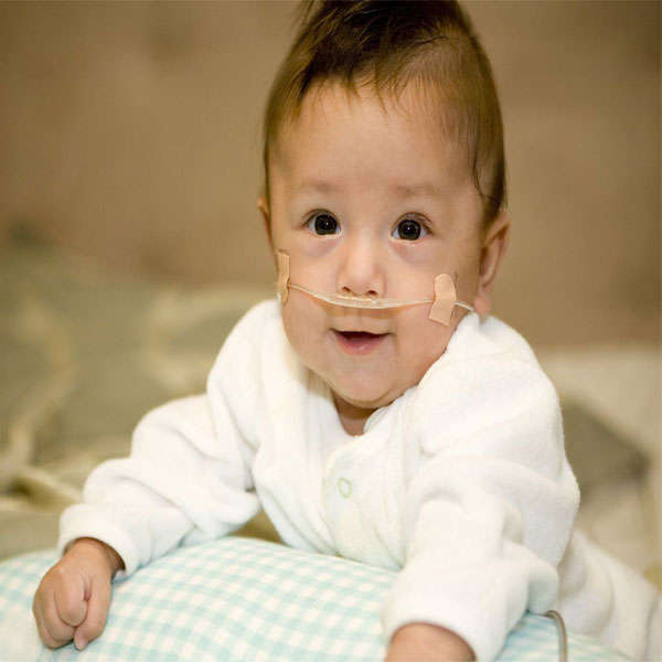 Oxygen Nasal Cannula - Neonate / Infant - 1.8m - 5 Pack