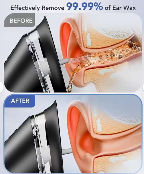 3 Mode Adjustable Electric Ear Wax Removal Kit