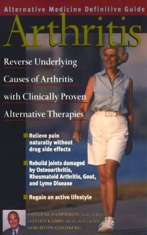 Arthritis : An Alternative Medicine Definitive Guide Paperback