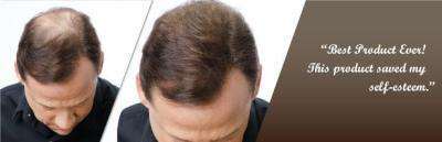 Toppik Hair Building Fibers - Medium Brown 27.5g (75 Day Supply)