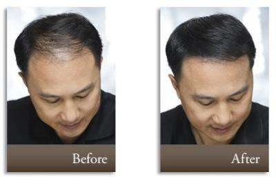 Toppik Hair Building Fibers - Medium Brown 27.5g (75 Day Supply)