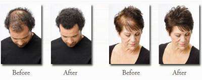 Toppik Hair Building Fibers - Medium Brown 27.5g (75 Day Supply)