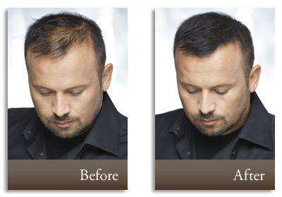 Toppik Hair Building Fibers - Medium Brown 27.5g (75 Day Supply)