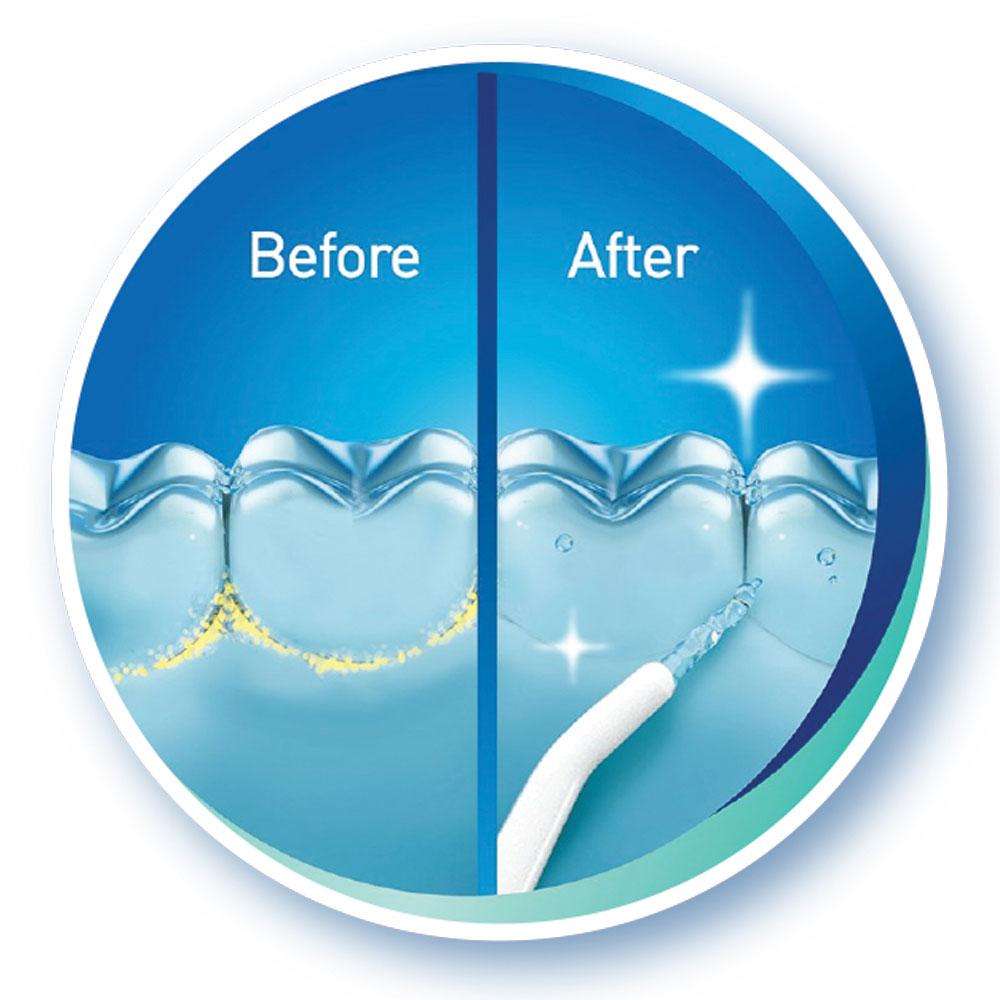 Igia Pressure Water Flosser Cordless