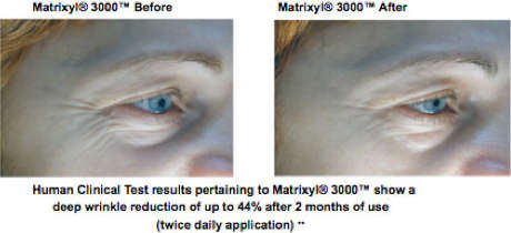 THE ORDINARY Matrixyl 10% +HA (Hyaluronic Acid) - 30ml Anti-aging Miracle Serum