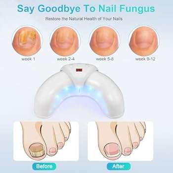 Nail Fungus Cleaning Device