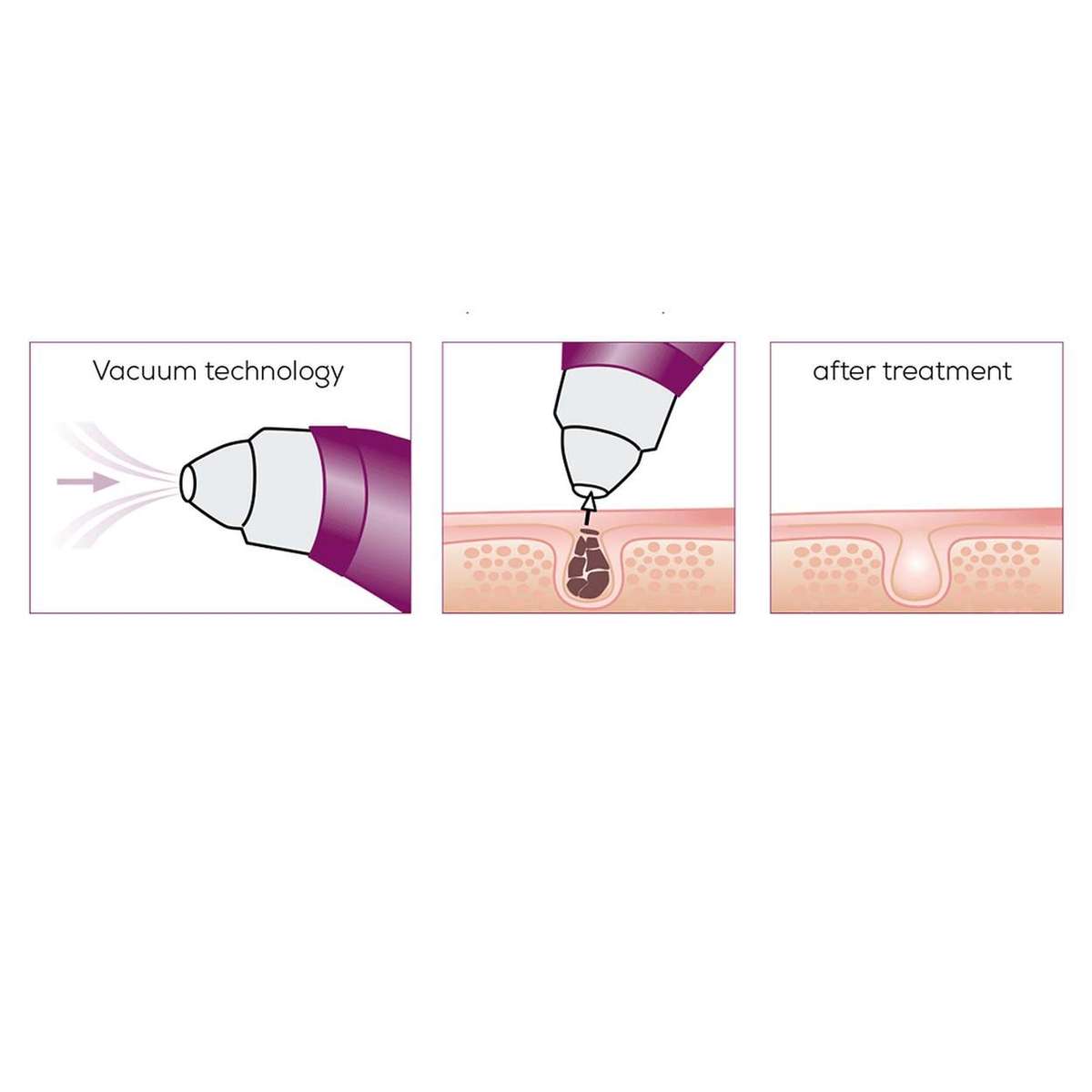 Beurer Power Deep Pore Cleanser FC 40