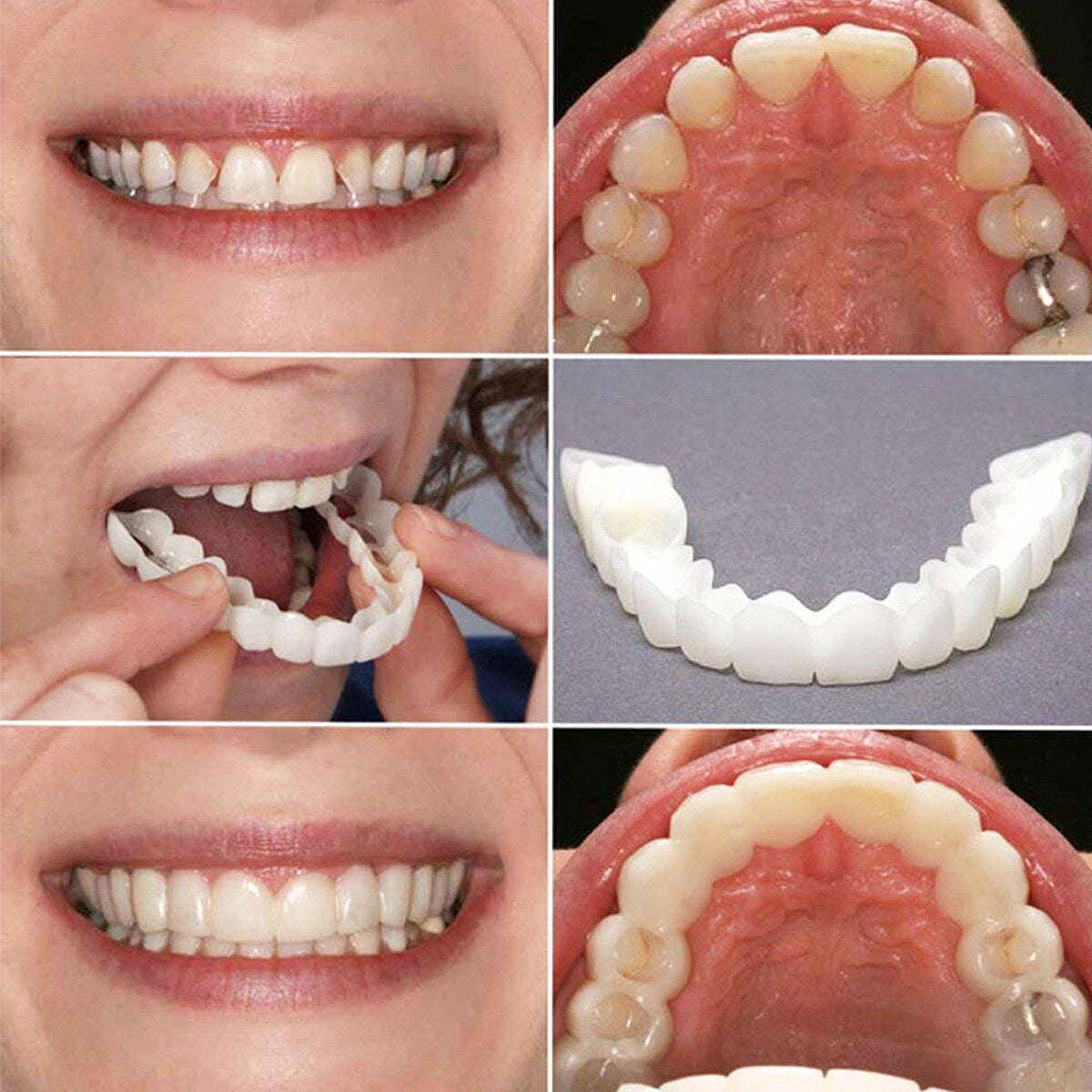 1 Pair Dentistry Cosmetic Covers Smile Comfort Veneers Flex Teeth Braces Upper +Bottom
