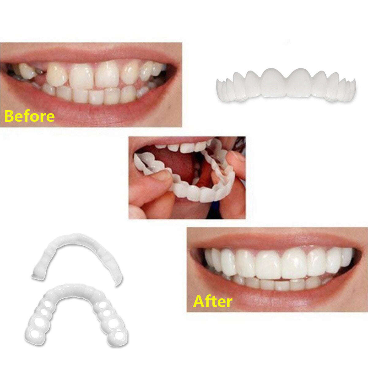 1 Pair Dentistry Cosmetic Covers Smile Comfort Veneers Flex Teeth Braces Upper +Bottom