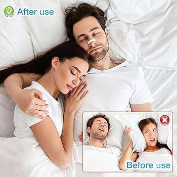 15-Day Nasal Dilator Kit