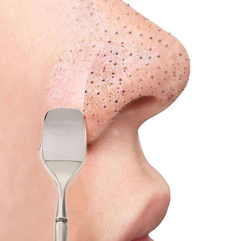 Stainless Steel Double-Ended Blackhead Remover Tool