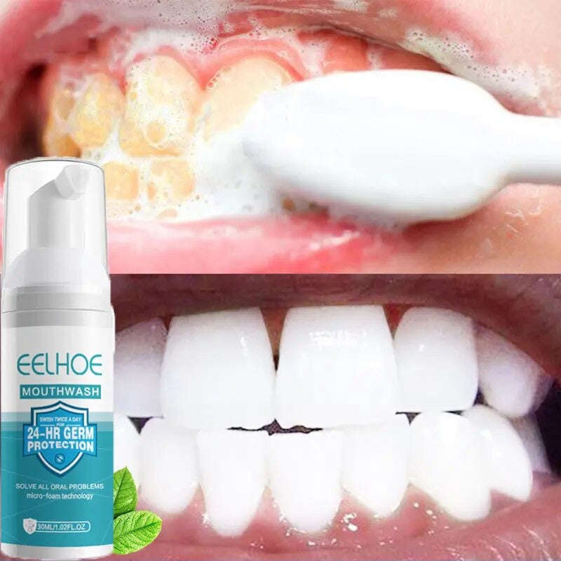 Teeth Whitening Mousse Toothpaste Dental Bleach Cleaning Tools Removes Stains Oral Hygiene Fresh ...