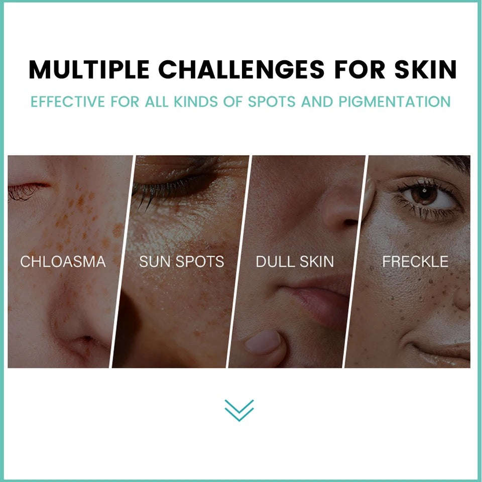 Dark Spot Corrector Cream Skin Whitening Spot Fade Anti-aging Cream For Women Girls Evens Skin To...