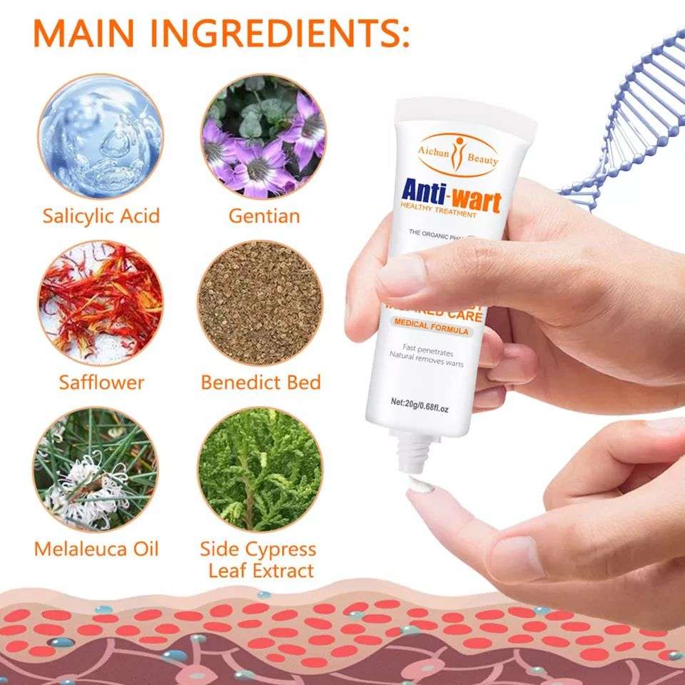AICHUN BEAUTY | Anti - wart cream