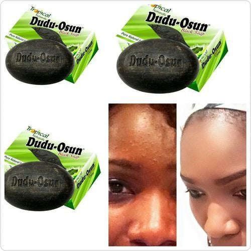 Dudu-Osun Dudu - Osun African BLACK SOAP-BLACK SPORTS,ECZEMA,ACNE,FRECKLES