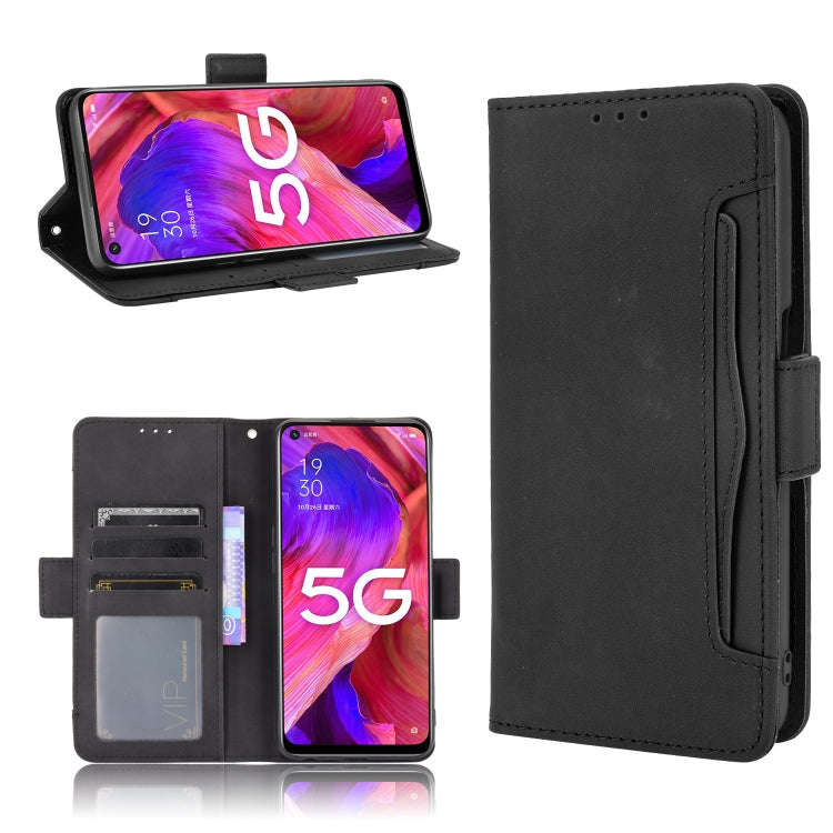 Skin Feel Calf Pattern Horizontal Flip Leather Case with Holder & Card Slots & Photo Frame, For O...
