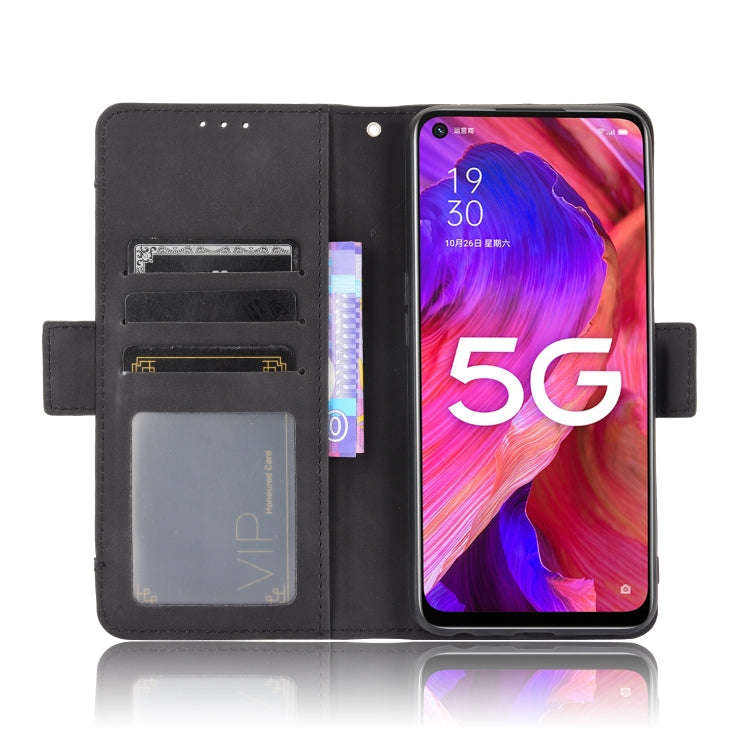Skin Feel Calf Pattern Horizontal Flip Leather Case with Holder & Card Slots & Photo Frame, For O...