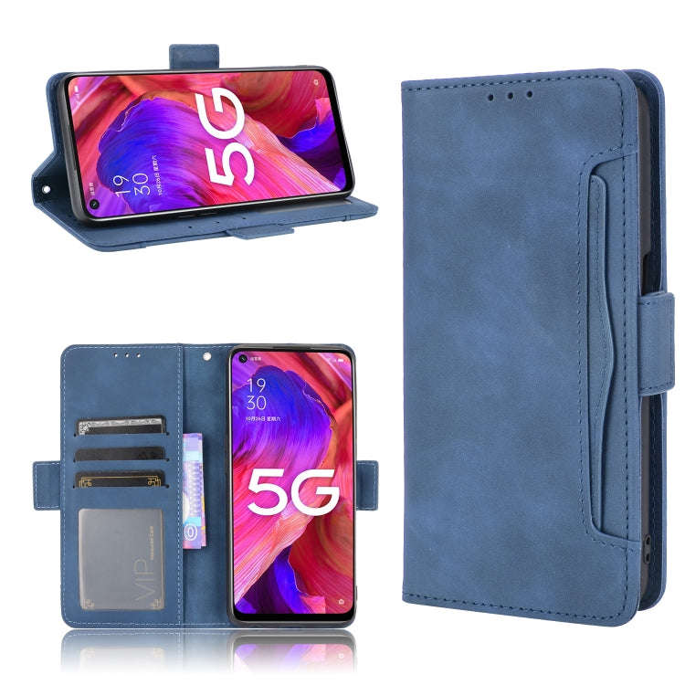 Skin Feel Calf Pattern Horizontal Flip Leather Case with Holder & Card Slots & Photo Frame, For O...