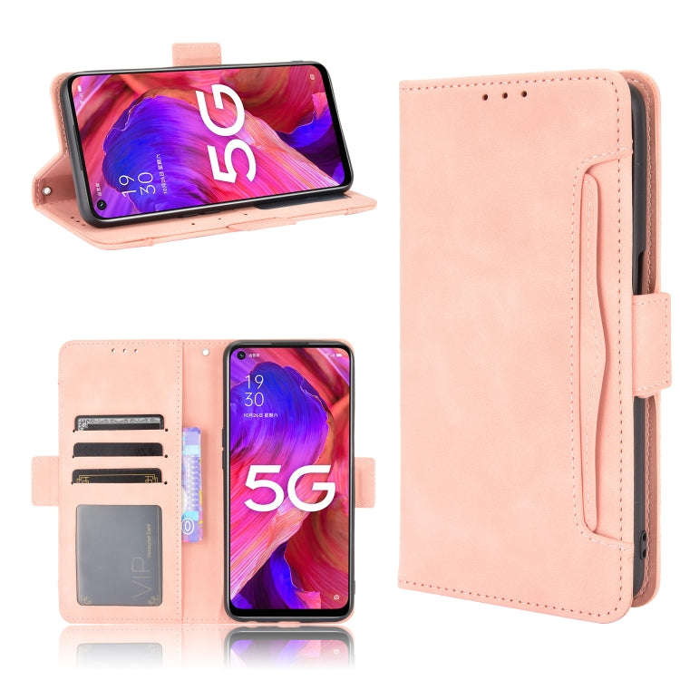 Skin Feel Calf Pattern Horizontal Flip Leather Case with Holder & Card Slots & Photo Frame, For O...