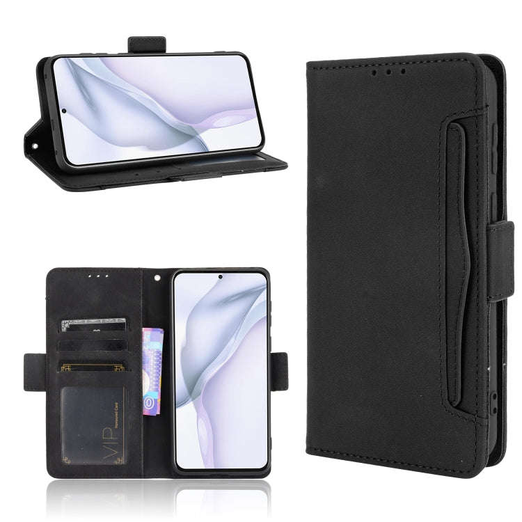 Skin Feel Calf Pattern Horizontal Flip Leather Case with Holder & Card Slots & Photo Frame, For O...