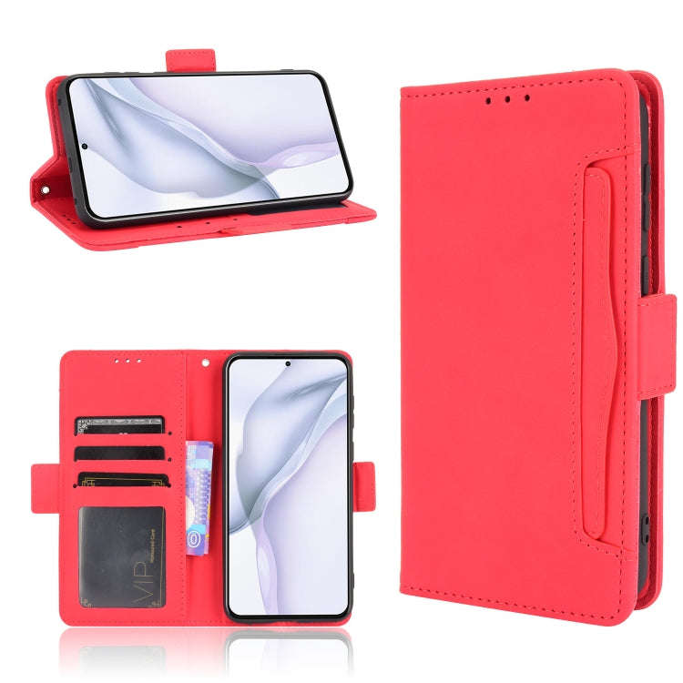 Skin Feel Calf Pattern Horizontal Flip Leather Case with Holder & Card Slots & Photo Frame, For O...