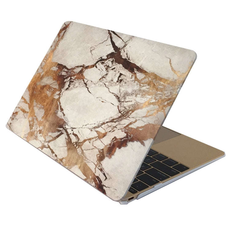 Marble Patterns Apple Laptop Water Decals PC Protective Case for Macbook Air 11.6 inch, S-MBC-210...
