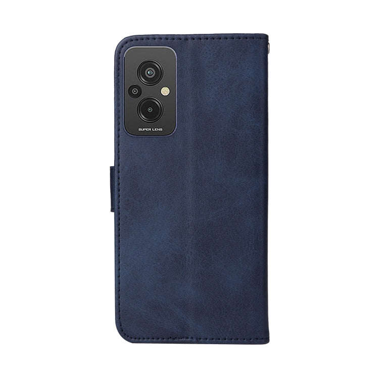 For Xiaomi Redmi 11 Prime 4G Classic Calf Texture Flip Leather Case(Blue)