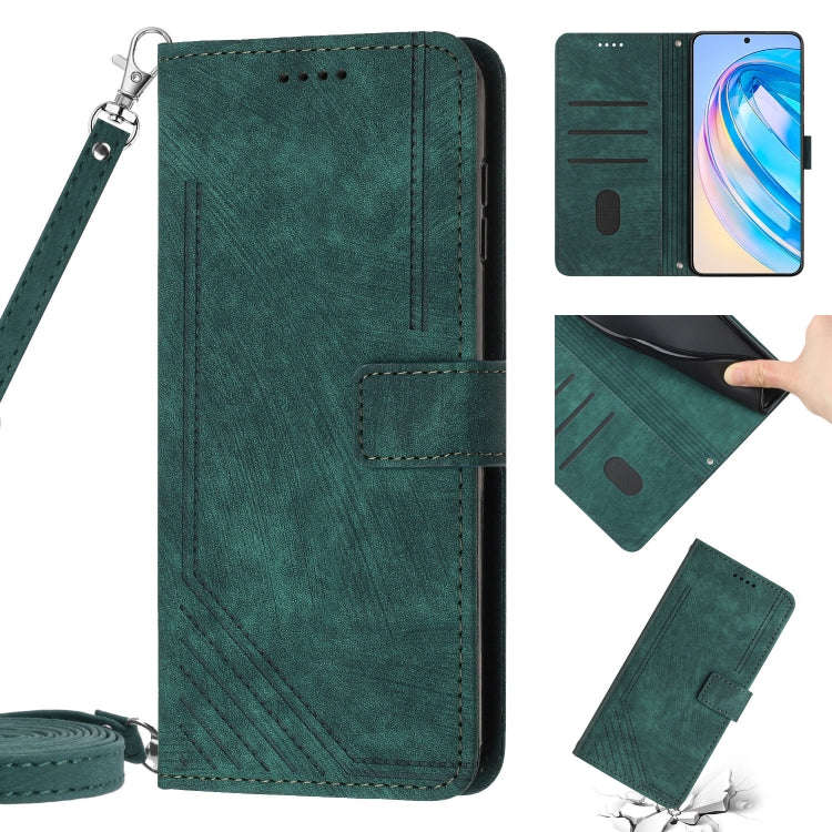 For Honor X9 5G&4G / X30 / Magic4 Lite Skin Feel Stripe Pattern Leather Phone Case with Lanyard(G...