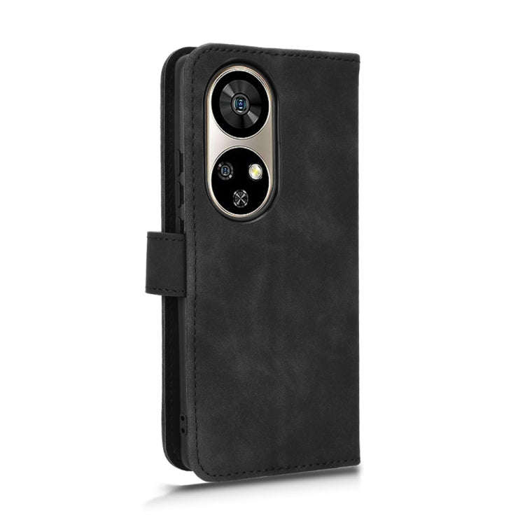 For Ulefone Note 17 Pro Skin Feel Magnetic Flip Leather Phone Case(Black)