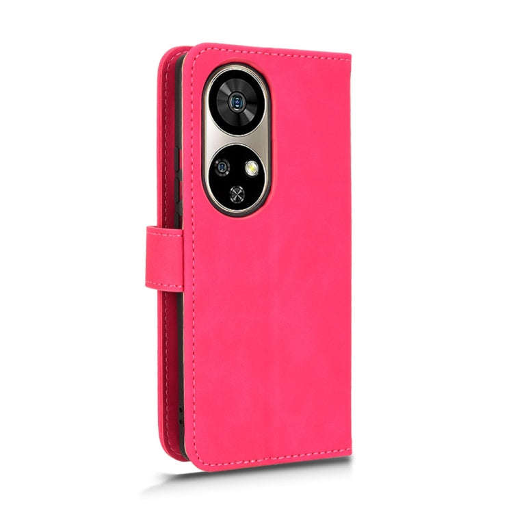 For Ulefone Note 17 Pro Skin Feel Magnetic Flip Leather Phone Case(Rose Red)