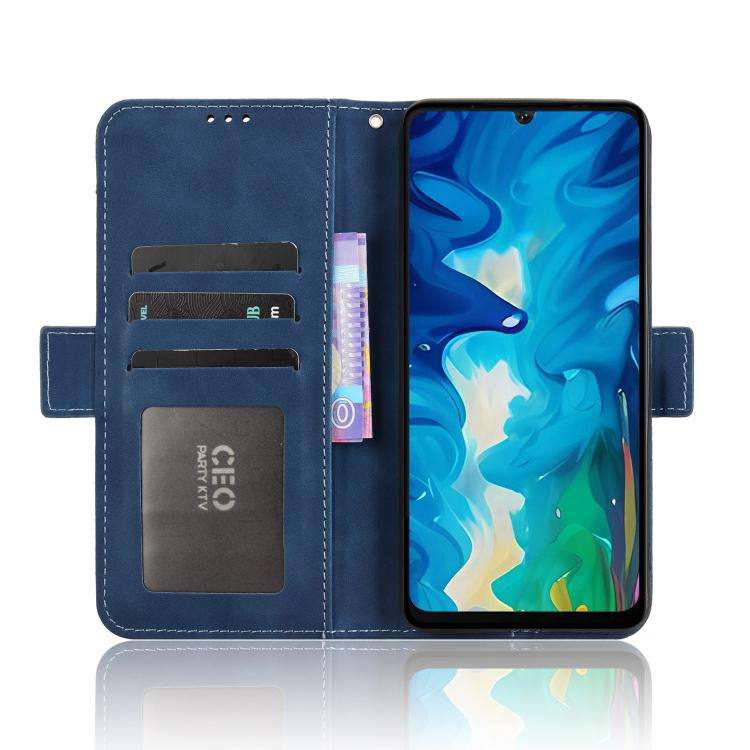 For Doogee Note 59 / Note 59 Pro Skin Feel Calf Texture Card Slots Leather Phone Case(Blue)