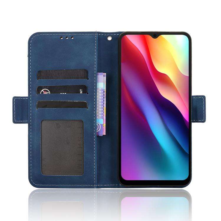 For Doogee Note 56 / Note 56 Pro Skin Feel Calf Texture Card Slots Leather Phone Case(Blue)