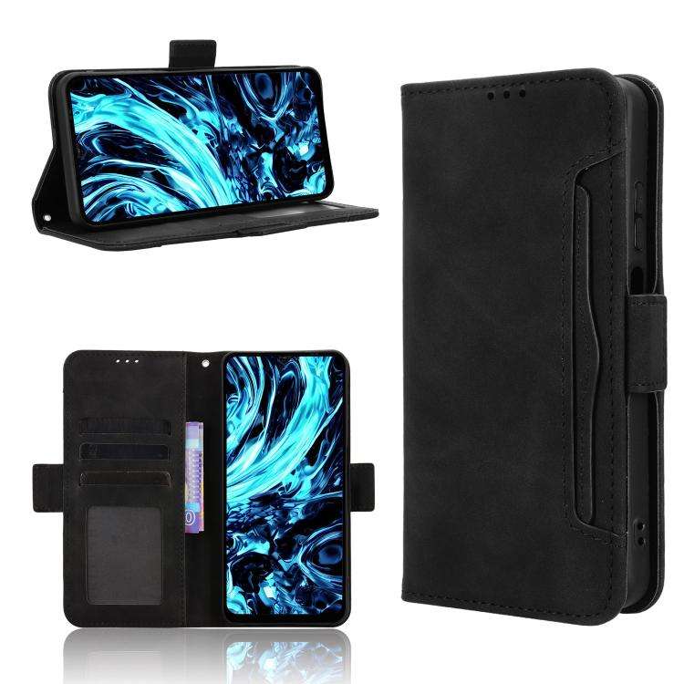 For Doogee Note 56X / Note 56X Pro Skin Feel Calf Texture Card Slots Leather Phone Case(Black)
