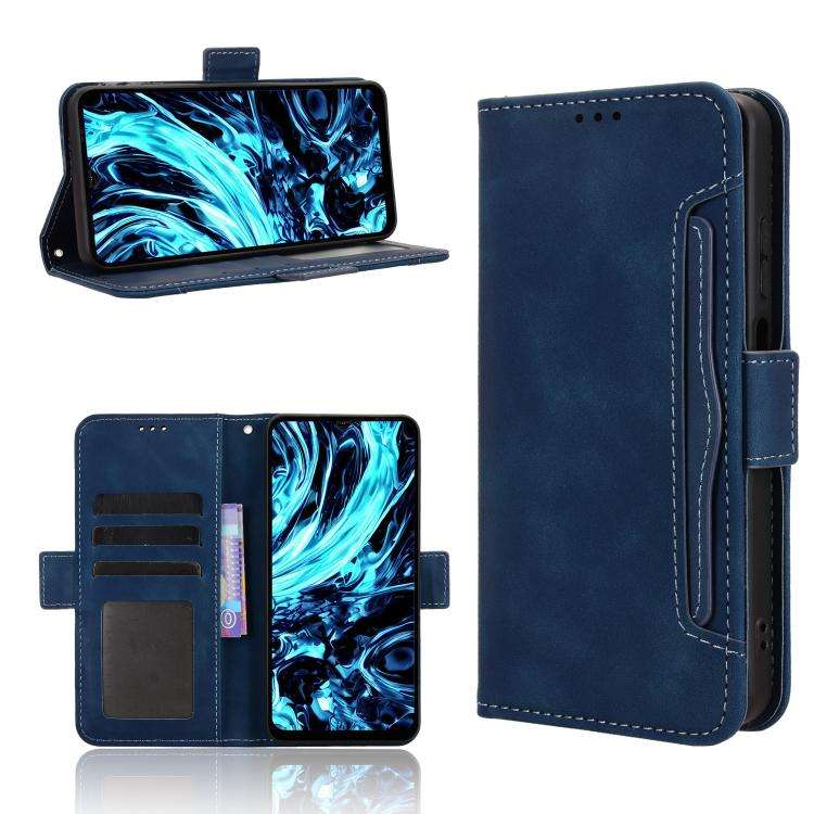 For Doogee Note 56X / Note 56X Pro Skin Feel Calf Texture Card Slots Leather Phone Case(Blue)