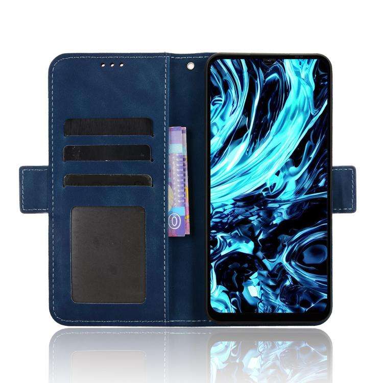 For Doogee Note 56X / Note 56X Pro Skin Feel Calf Texture Card Slots Leather Phone Case(Blue)