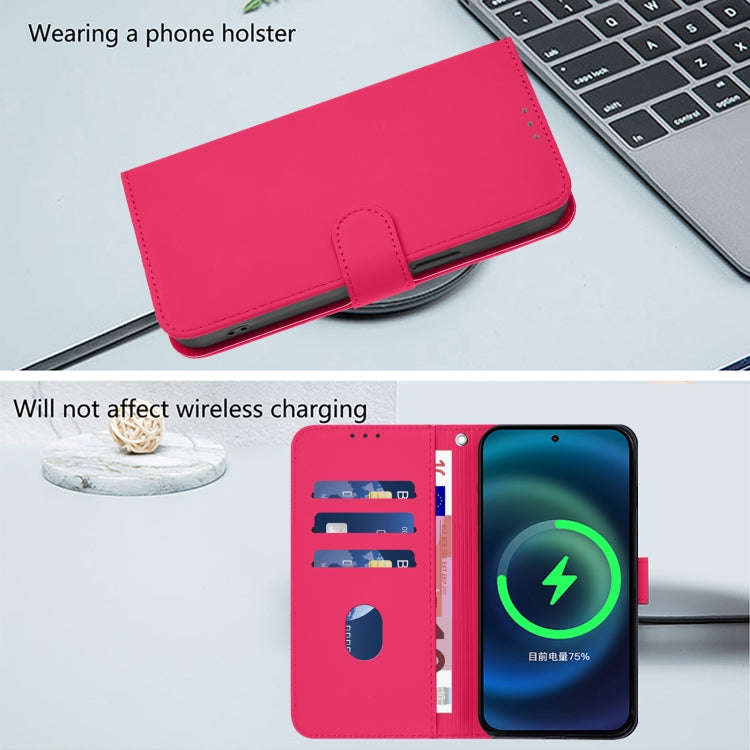 For Ulefone Note 17 Pro Skin Feel Solid Color Leather Phone Case with Lanyard(Rose Red)