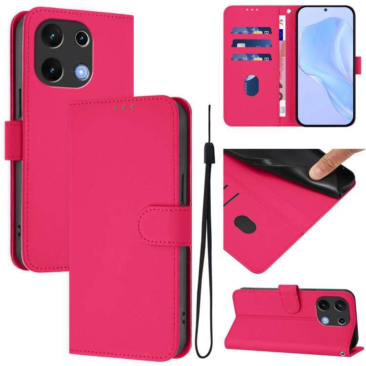 For Umidigi Note 100 Skin Feel Solid Color Leather Phone Case with Lanyard(Rose Red)